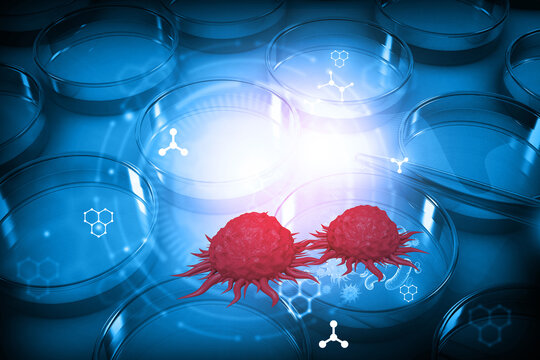 3D cancer cells on scientific chemistry blue background illustrating oncology research, molecular studies, biotechnology, and advanced medical discoveries.
