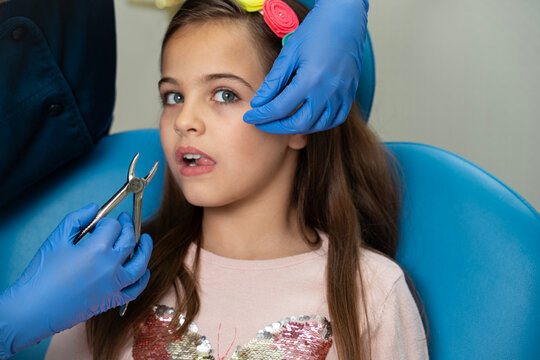 A dentist uses dental extraction forceps to pull a baby tooth on a little worried young girl