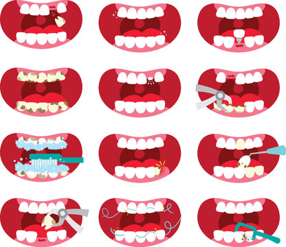 Twelve Dental Condition Illustrations for Oral Health Education