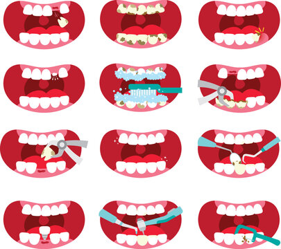 Dental Care Procedures and Oral Health Problems Illustration Set