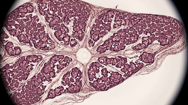 Healthy liver tissue toward chronic cirrhosis, beginning with organized hepatocyte plates, open hepatic sinusoids and healthy liver architecture, then gradually developing increasing fibrous 