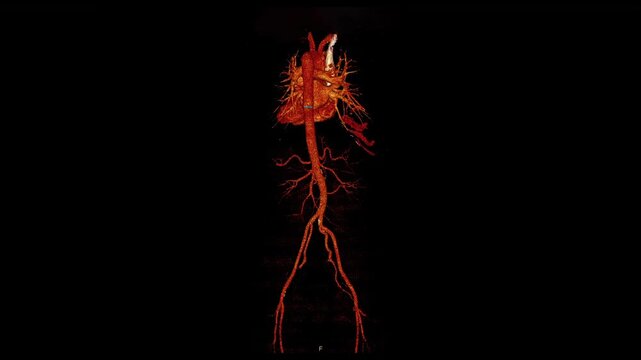 heart x-ray image or cardiovascular Imaging scan motion by mri ct scan.  concept of cardiology, cardiothoracic, heart disease.
