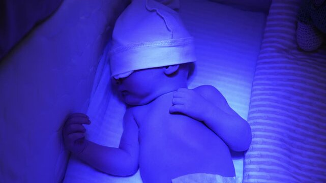 Tiny newborn baby receiving phototherapy treatment for jaundice while sleeping in a bassinet, the blue light lamp helping to reduce high levels of bilirubin in the infant's blood