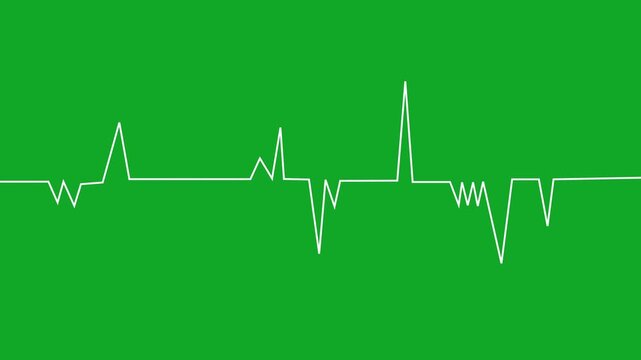 Green electrocardiogram lines pulse across monitor, illustrating heartbeat rhythm and suitable for healthcare, cardiology, medical technology, and digital wellness designs.
