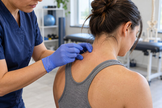 Trigger Point Dry Needling for Myofascial Neck and Shoulder Pain