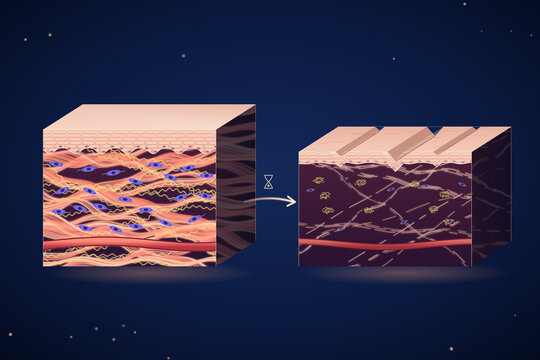 Young skin vs aged skin cross section, dense collagen and elastin network compared with fragmented extracellular matrix and wrinkles