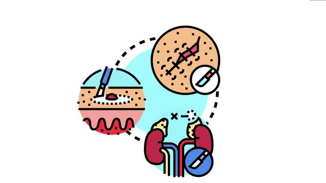 Ovarian excision concept showing a medical professional performing a surgery to remove tissue, gynecological treatment and reproductive health care