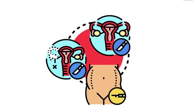 Ovarian removal procedure involves surgical methods to remove diseased ovaries, addressing conditions like ovarian cysts, cancer, or endometriosis, focusing on women's health and gynecological care
