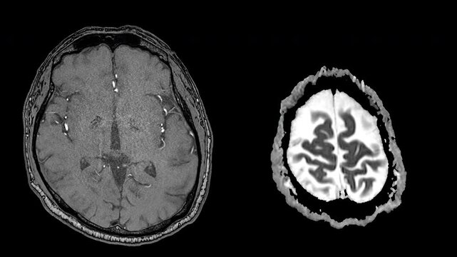 Brain CT Scan Axial Slices, Split-Screen Medical Imaging Sequence