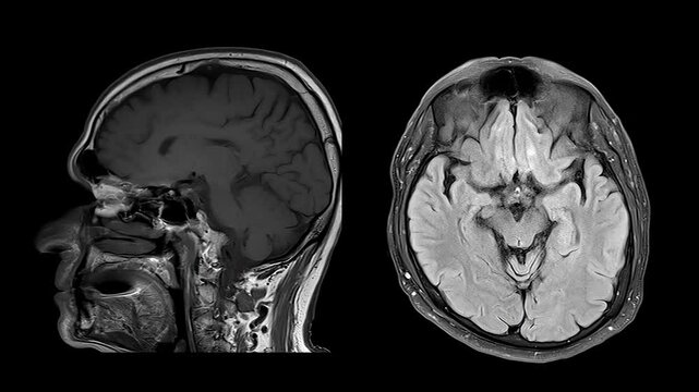 Brain MRI Scan Sagittal and Axial Views, Medical Imaging Diagnostics