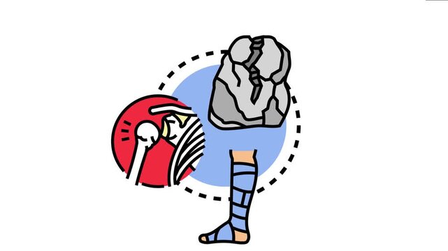 Post injury recovery concept the process of healing and rehabilitation after an accident or physical trauma, featuring an orthopedic brace, a fractured bone, and a damaged structure