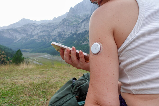 A young woman with a continuous glucose monitor sensor taped to her upper arm checks her blood sugar data on a smartphone while resting beside a backpack above an alpine valley, remote self care.
