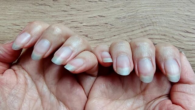 Woman places her hands on a manicure table. Nails without manicure, with cuticles. Self care.