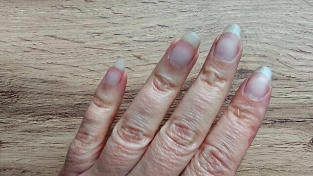 Woman places her hands on a manicure table. Nails without manicure, with cuticles. Self care.