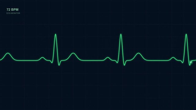 ECG heartbeat line scrolling on medical grid loop