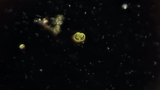 Microscopic organism Cosmarium desmid alga in puddle water darkfield high magnification 400x