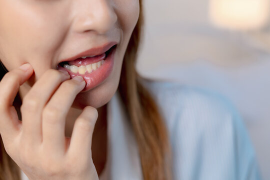 Close-up of woman pulling down her lower lip to check mouth pain, toothache, canker sore, mouth ulcer, swollen gums, oral discomfort, dental health and oral hygiene concerns.