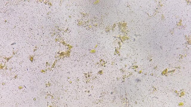 Microscopic footage of human feces or stool showing Cysts of giardia lamblia. Cysts of giardia lamblia and bacteria in stool. 