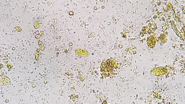 Microscopic footage of human feces or stool showing Cysts of giardia lamblia. Cysts of giardia lamblia and bacteria in stool. 