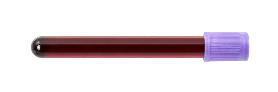 Single blood sample tube with a purple cap contains dark red liquid, isolated on a clean white background
