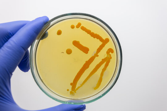 Orange streaks of yeast bacterial colonies on a Petri dish held in a scientist's hand against a white background.
