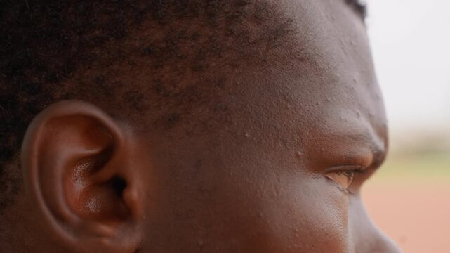 Close up view shows side profile of adult male subject. focus is on his ear and face with fine details like skin texture including small bumps or pores indicating possible heat exposure such