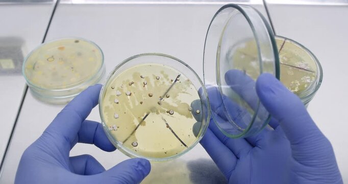 A scientist opens a Petri dish and shows kidney-shaped bacterial colonies that have grown on the surface of other bacteria. Competitive bacterial growth on nutrient agar in a laboratory.