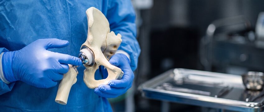 Orthopedic surgeon holding a total hip replacement implant model with artificial joint and pelvic bone in the operating room
