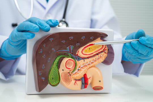 Pancreatitis, pancreatic cancer, Asian doctor with pancreas, gallbladder and bile duct human model.