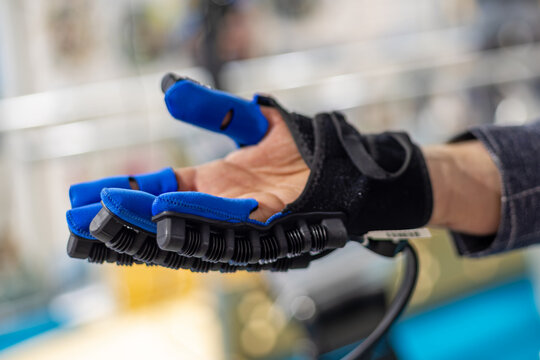 Close up of a robotic rehabilitation glove with blue finger supports and flexible mechanical joints, wearable assistive device for hand therapy and restoring finger mobility.