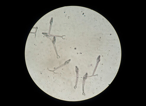 larval stage and cercariae of Schistosoma mansoni, a water borne parasite of humans, causing Schistosomiasis, also known as snail fever