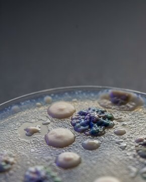 Extreme macro view of bacterial and fungal colonies growing inside a culture plate, symbolizing microbiological research, infection analysis, and pathogen identification.
