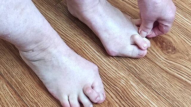 Close-up of elderly feet with hammertoe and bunion deformity on wooden floor, foot problems and toe correction concept