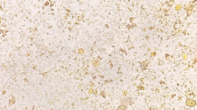 Microscopic footage of human feces or stool showing Eggs (Ova) of taenia species. Eggs (Ova) of taenia species and bacteria in stool. 