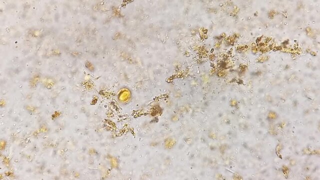 Microscopic footage of human feces or stool showing Eggs (Ova) of taenia species. Eggs (Ova) of taenia species and bacteria in stool. 