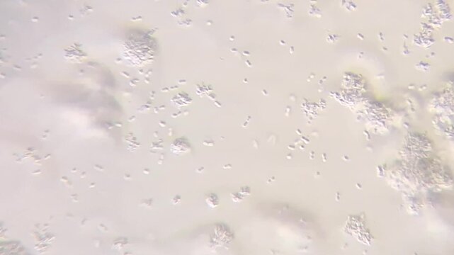 Microscopic View of Bacteria and Yeasts in Fermented Milk Probiotics
