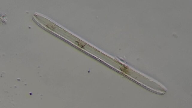 Diatom Microscopic View: Freshwater Microalgae Under Microscope