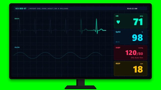 Medical ICU Patient Monitor EKG Heartbeat On Green Screen 4K