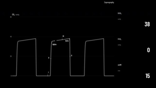 Normal Capnogram Waveform Phases Labeled EtCO2 Seamless Loop Alpha
