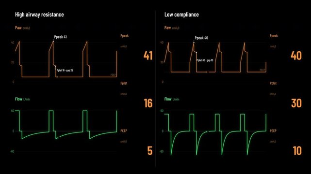 Ventilator Peak and Plateau Pressure High Resistance vs Low Compliance