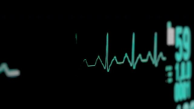 Heart rate monitor beside an operating table. Vital signs during anesthesia and surgery