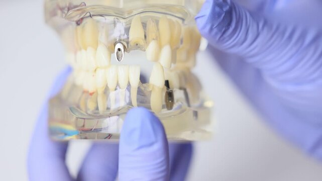 A gloved hand displays a dental jaw model with marked teeth roots today
