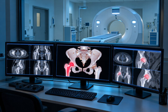 AI-generated photorealistic stock image of photorealistic image of a ct scanner control console room with multi-monitor workstation, lead glass observation window showing ct gantry room beyond, no peo
