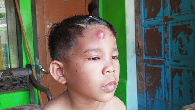 A boil or lump on the forehead can cause swelling around the face; this is due to the interconnected anatomical pathways of blood vessels, inflammatory reactions, and the spread of infection.