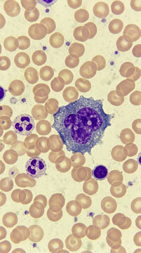 Microscopic view of human blood cells monocytes neutrophils and erythrocytes under magnification Medical science