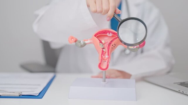Doctor with Uterus and Ovaries anatomy model. Ovarian and Cervical cancer, Cervix disorder, Endometriosis, Hysterectomy, Uterine fibroids, Reproductive system, Pregnancy and health concept