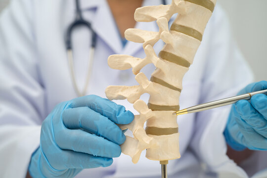 Doctor holding osteoporosis in back bone model for treatment medical in orthopedic department.
