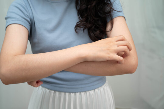 Asian woman itching of skin diseases using hand scratching.