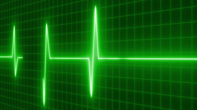 Bright ECG heartbeat waveform on dark grid background animation, glowing pulse line across monitor
