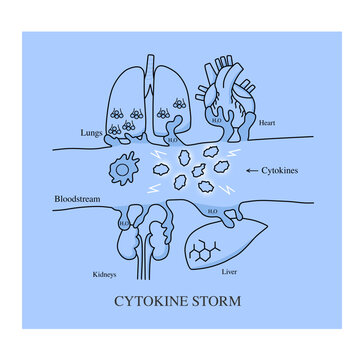 Cytokine Storm